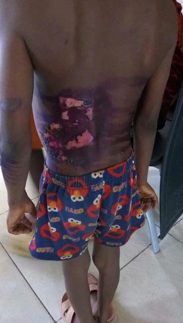 Photos: Man arrested in Abuja for burning 7-year-old son with hot pressing iron over food