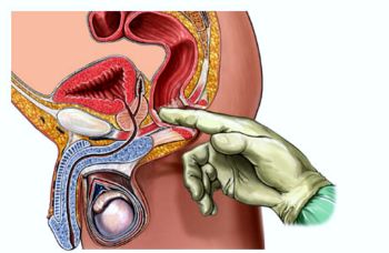 Benjolan Di Anus Setelah Bab