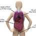 Mesothelioma