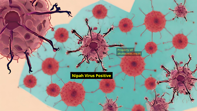 Virus Nipah Positive
