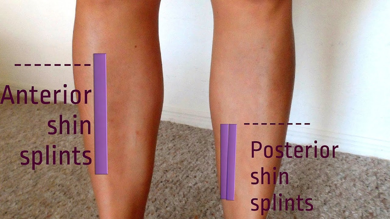 Shin splints - Shin Injuries Injury