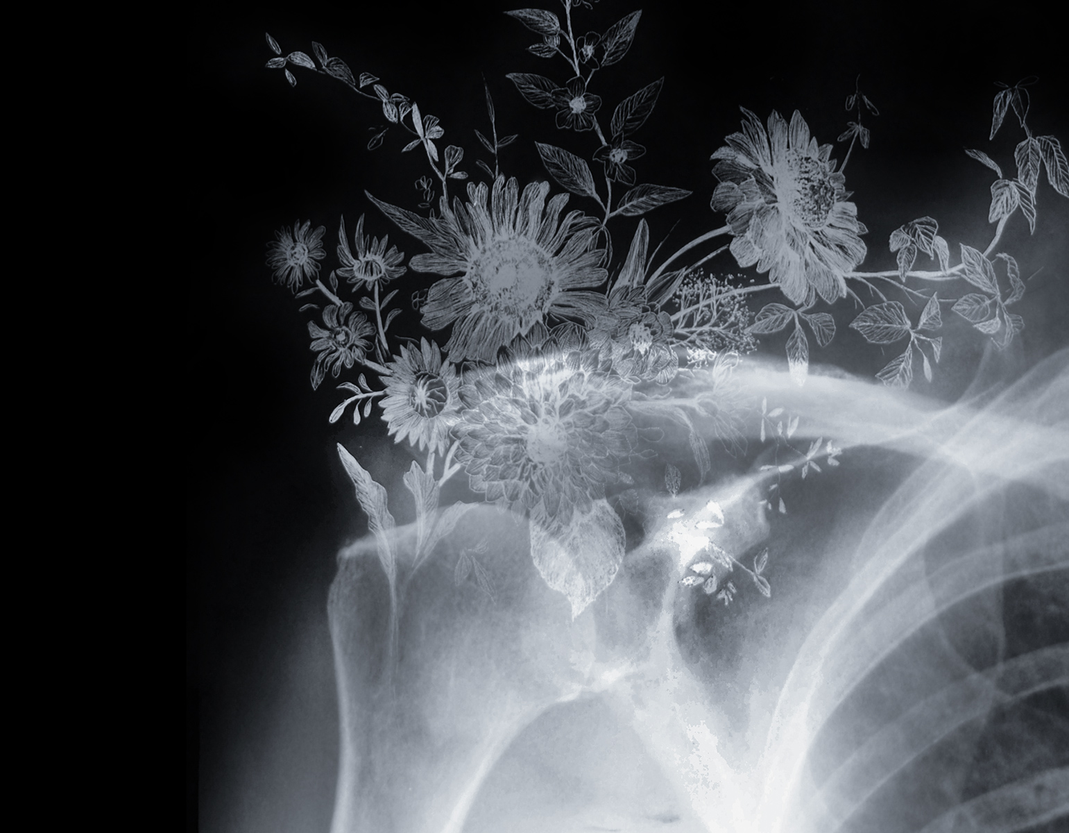 Nunzio Paci - Kengai, Manually altered x-ray on LED lightbox