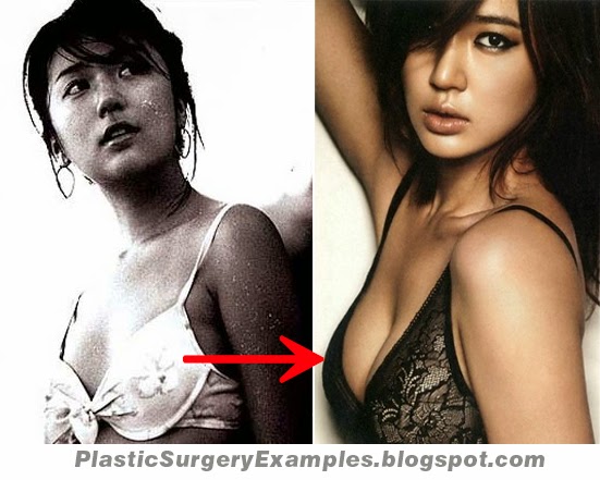 Plastic Surgery Examples