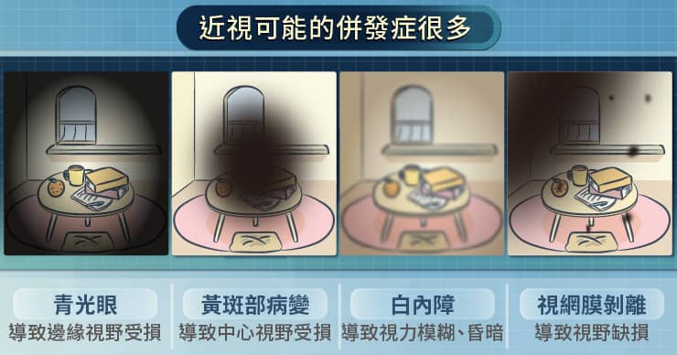 近視500度以上可能導致多種併發症