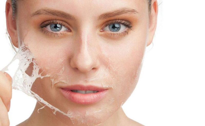 What to Know About Chemical Peels