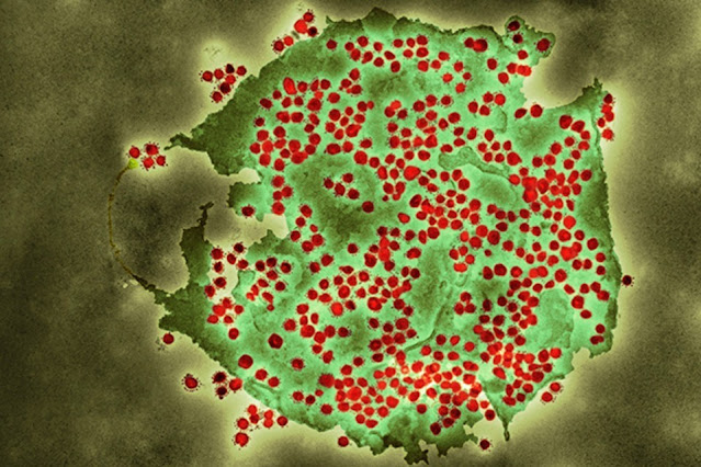 New COVID variant spreading across UK as cases rise