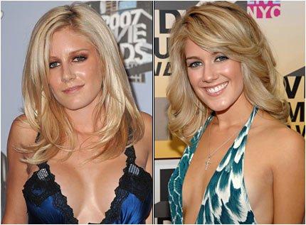 heidi montag surgery people. hairstyles Heidi Montag#39;s