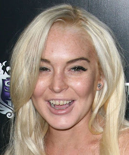 Lindsey Lohan Teeth