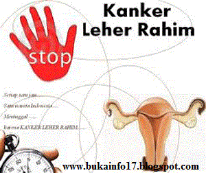 http://bukainfo17.blogspot.co.id/2017/11/kanker-leher-rahim-dan-gejalanya.html