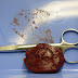 First Liver Surgery with Tablet Computer in Germany