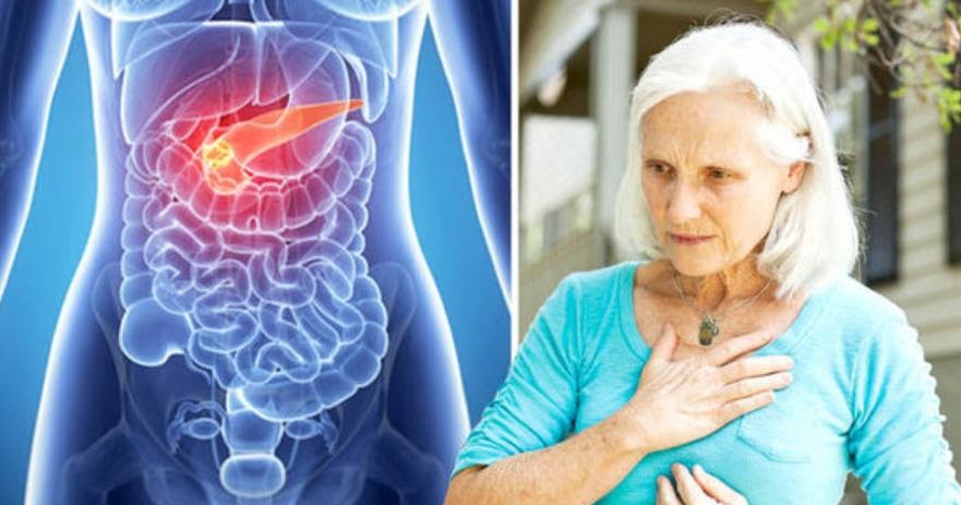 What Are The Symptoms Of Pancreatic Cancer In A Woman ...
