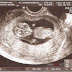 Ultrasound Experience At St. Hannah