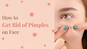 Get rid of pimples