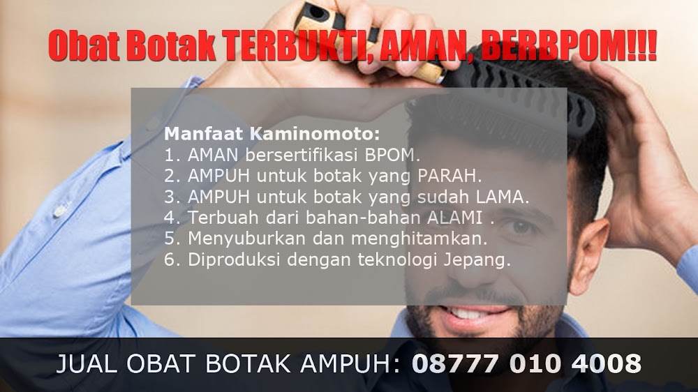 jual OBAT PENUMBUH RAMBUT BOTAK Banda Aceh<br/>