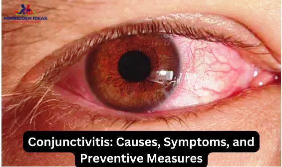Conjunctivitis: Causes, Symptoms, and Preventive Measures