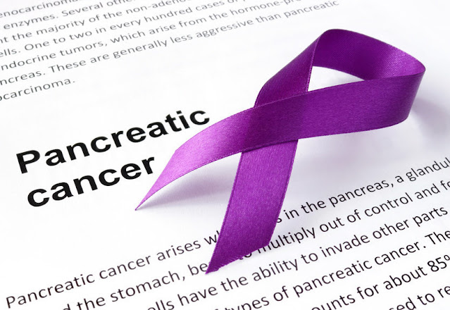 pancreatic-survival-rate