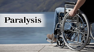 Ayurvedic Treatment for Paralysis