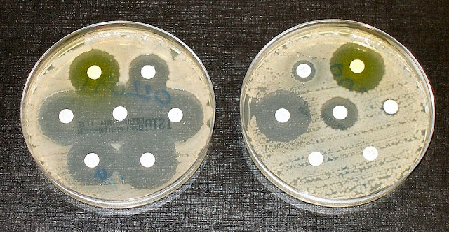 Photograph of antibiotic resistance tests