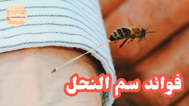 علاج السرطان بسم النحل