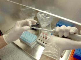 Científicos descubren nuevo virus mortal en Africa