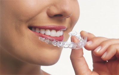 Invisalign Flemington