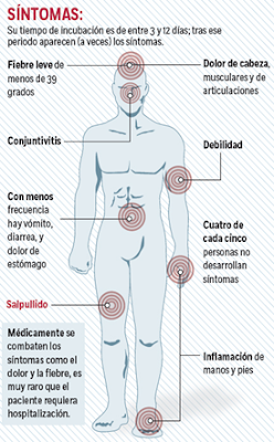 síntomas del zika