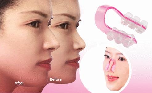 Dr Chytra Nose Shaping treatment