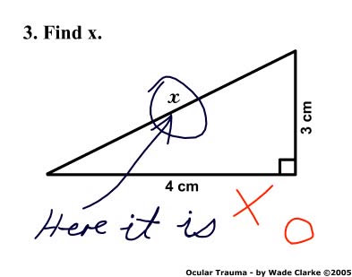 Anonymous Brain: Funny Test Answers