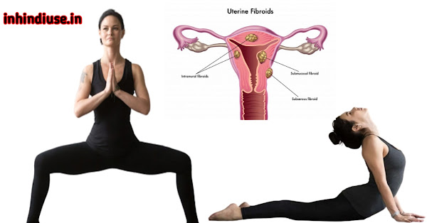 गर्भाशय में सूजन के घरेलू उपचार | bulky uterus in hindi