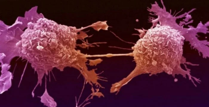 Σπουδαία ανακάλυψη Έλληνα επιστήμονα: Μετατρέπει τα καρκινικά κύτταρα σε υγιή!