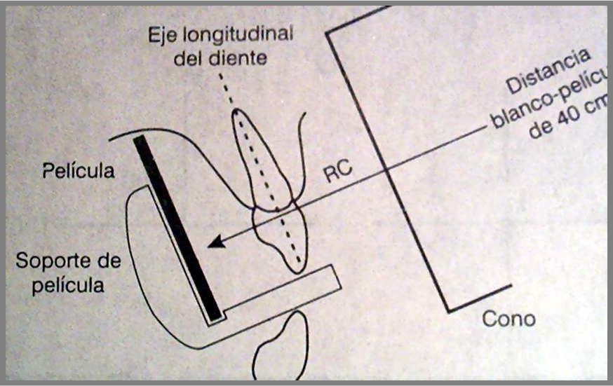 Resultado de imagen para tecnica paralelismo