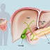 Bệnh gan ứ mật là gì? Nguyên nhân và cách điều trị