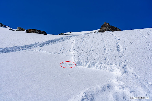 Gering mächtiges Schneebrett im extrem steilen, schattigen Gelände unterhalb der Vorderen Jamspitze in der Silvretta. 2900m, NNO. Eingekreist erkennt man eine dünne Kruste, die am 25.04. entstanden ist. Darunter bildete sich in kurzer Zeit aufgrund großer Temperaturgegensätze (Gefahrenmuster "kalt auf warm") eine dünne Schwachschicht. Dieses Problem ist wohl nur sehr vereinzelt anzutreffen. Meist wird das über der Schwachschicht befindliche Brett wohl zu wenig ausgeprägt sein. Vorsicht am ehesten in unmittelbarem Kammbereich.