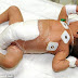 Bayi Dengan 6 Kaki, Sudah Tinggal 2 Kaki Kerana Pembedahan Yang Berjaya