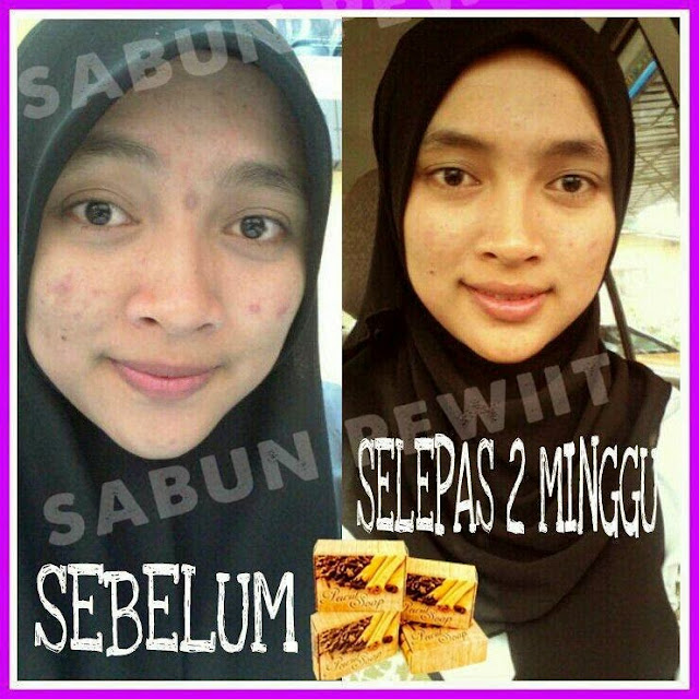 Pewiit Soap & Pewiit Skincare Murah