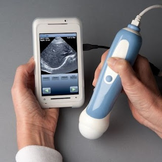 Here's 8 smart gadgets and unique for the baby
