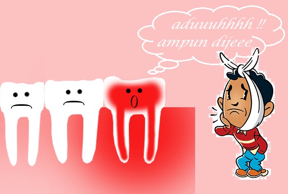 Cubalah! 15 Cara Menghilangkan Sakit Gigi Tanpa Ubat