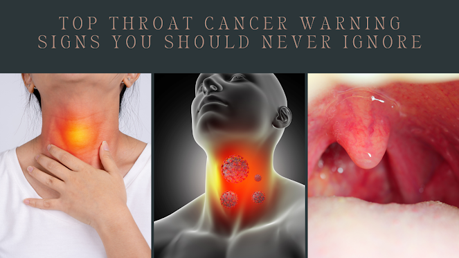 throat cancer