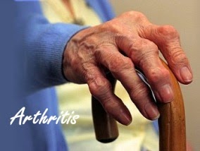 Arthritis