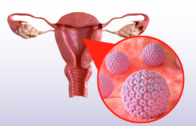 Symptoms of HPV