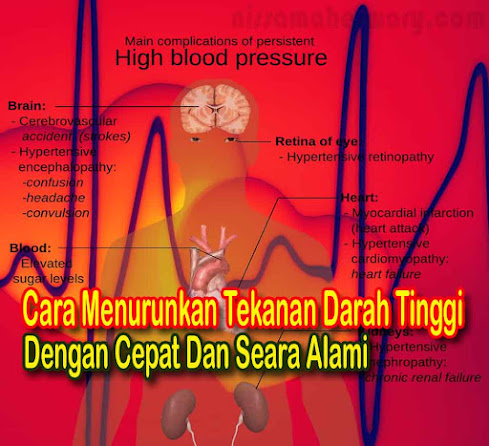 Cara Menurunkan Tekanan Darah Tinggi Dengan Cepat Dan Alami