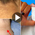 How To Make Homemade Cream To Lighten Dark Neck Very Fast