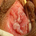 Jual Obat Kutil Kelamin Wanita thumbnail