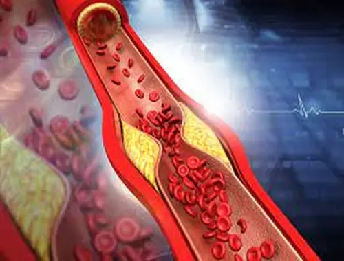 The Ultimate Guide to Clearing Clogged Arteries Naturally