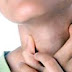Resep Pengobatan Penyakit Amandel thumbnail