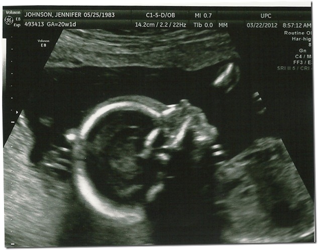 SCAN0086