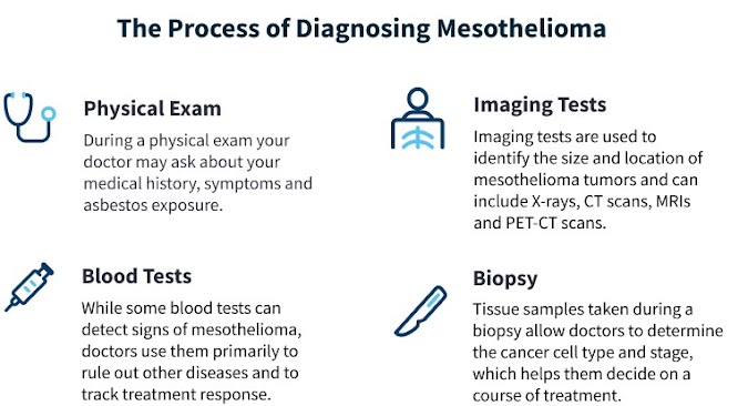  About Mesothelioma, Its Symptoms, Causes and Treatment