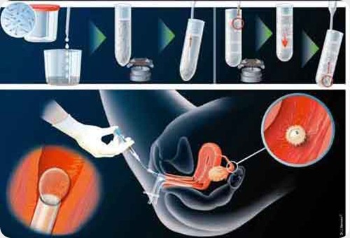 inseminacion artificial1