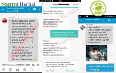 Luar Biasa ! 7 Bahan Alami Ini Ampuh Atasi Kutu Air