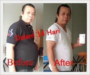 Testimoni L'arome Slimming Serum Pelangsing Ajaib